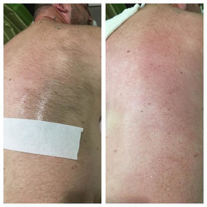 Bilder Ipanema Waxing, Beauty & Bademode