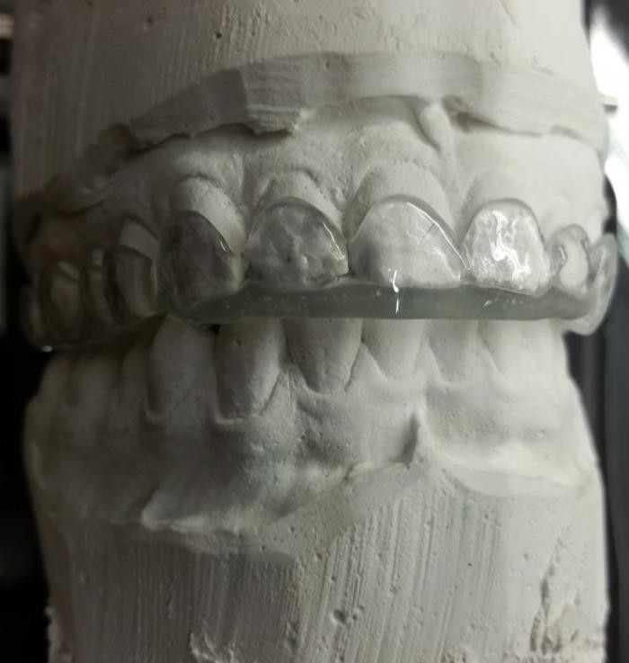 Bilder Die Prothesenschmide