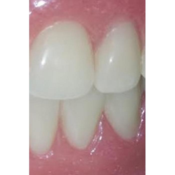 Bilder Die Prothesenschmide