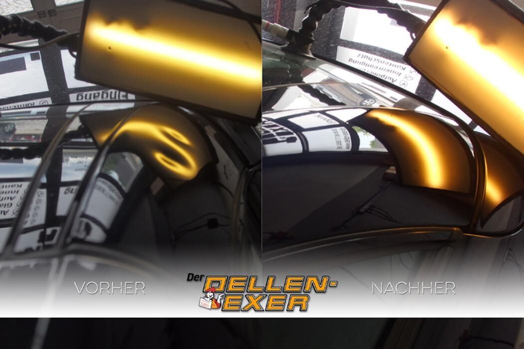 Bilder Der Dellen-Exer