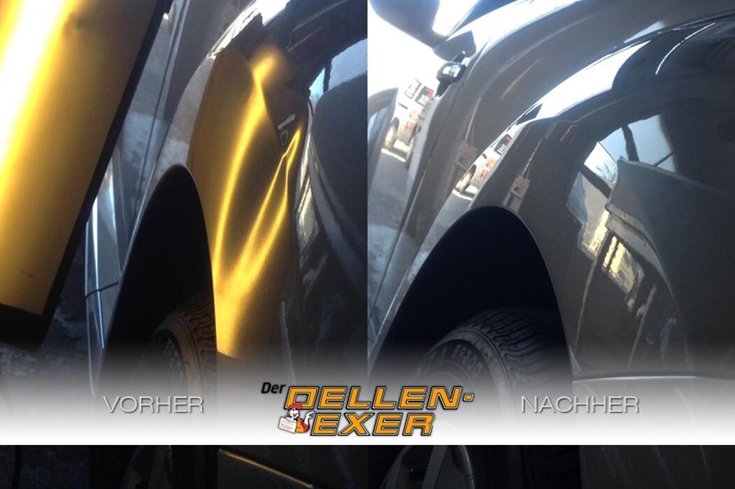 Bilder Der Dellen-Exer