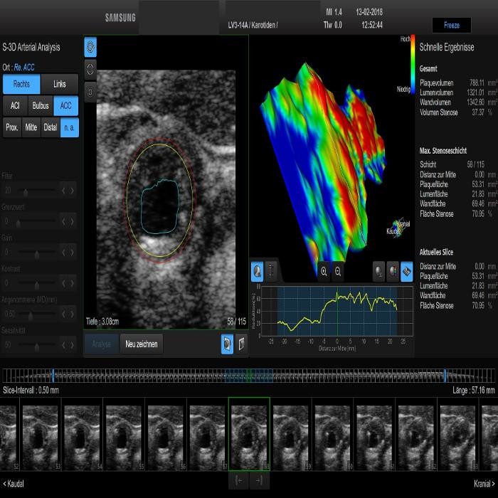 Bilder Akademie für kardiovaskulären Ultraschall GbR