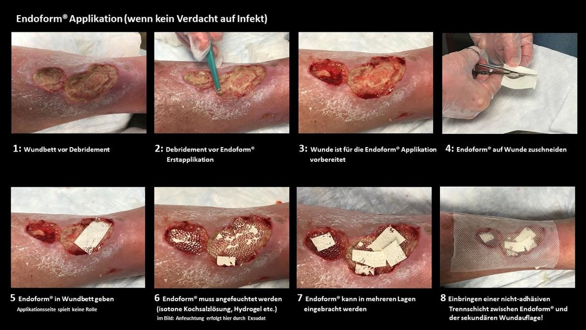 Bilder MICRO-MEDICAL Instrumente GmbH