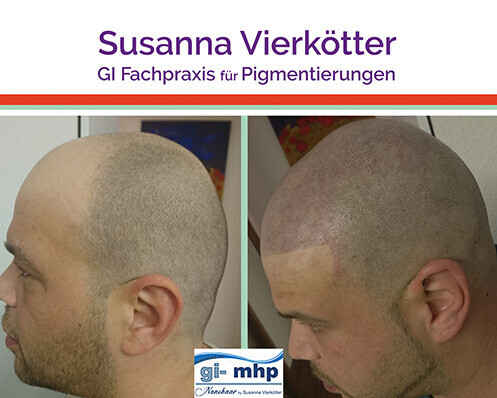 Bilder GI-MHP Ultra Nano Haarpigmentierung