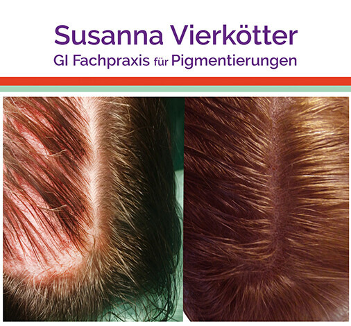 Bilder GI-MHP Ultra Nano Haarpigmentierung