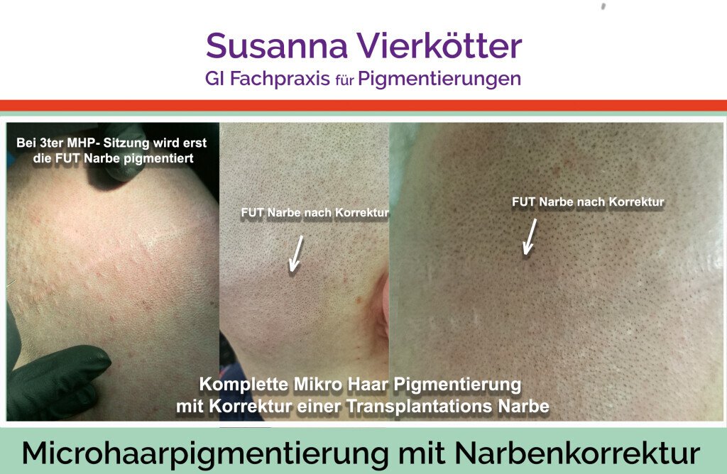 Bilder GI-MHP Ultra Nano Haarpigmentierung