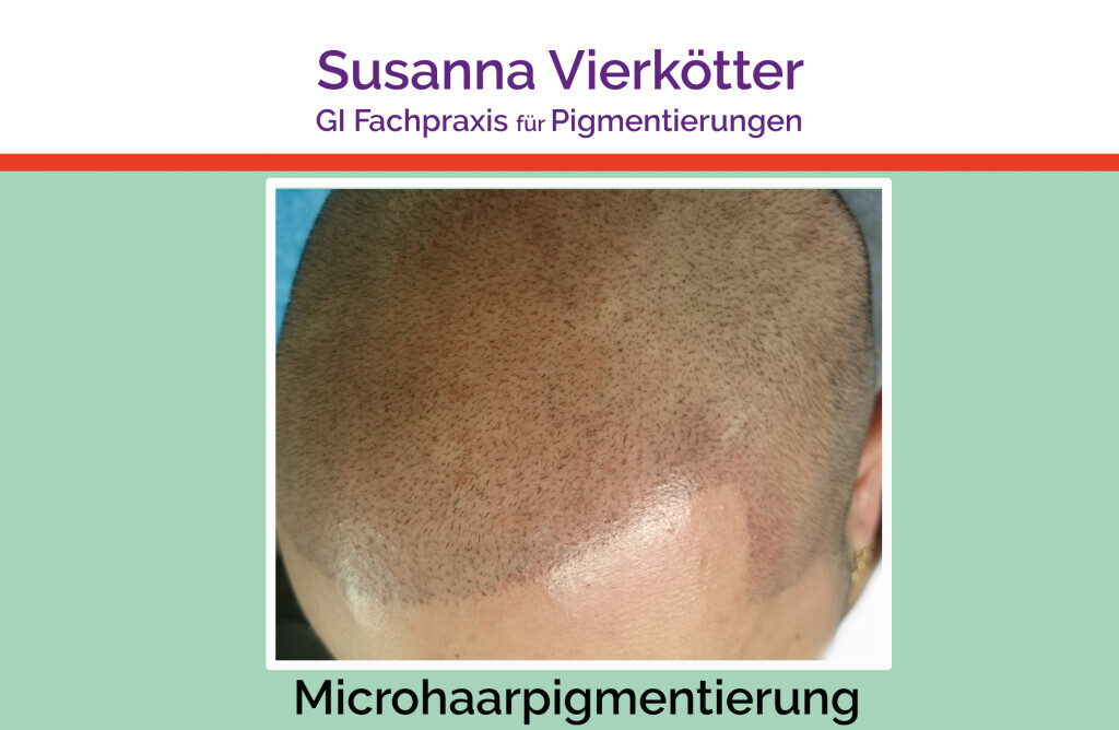 Bilder GI-MHP Ultra Nano Haarpigmentierung