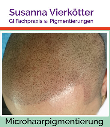 Bilder GI-MHP Ultra Nano Haarpigmentierung