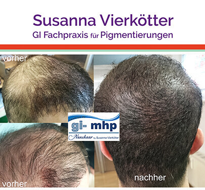 Bilder GI-MHP Ultra Nano Haarpigmentierung