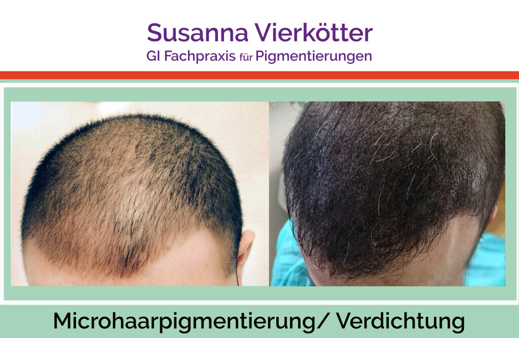 Bilder GI-MHP Ultra Nano Haarpigmentierung
