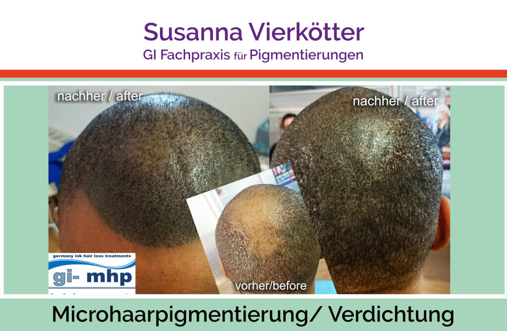 Bilder GI-MHP Ultra Nano Haarpigmentierung