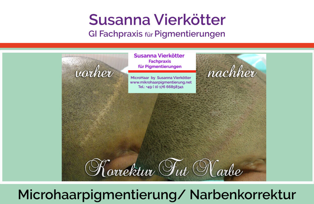 Bilder GI-MHP Ultra Nano Haarpigmentierung