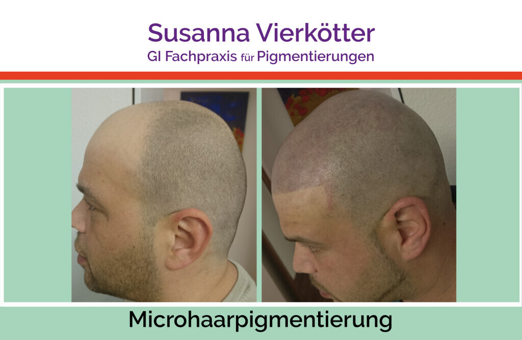 Bilder GI-MHP Ultra Nano Haarpigmentierung