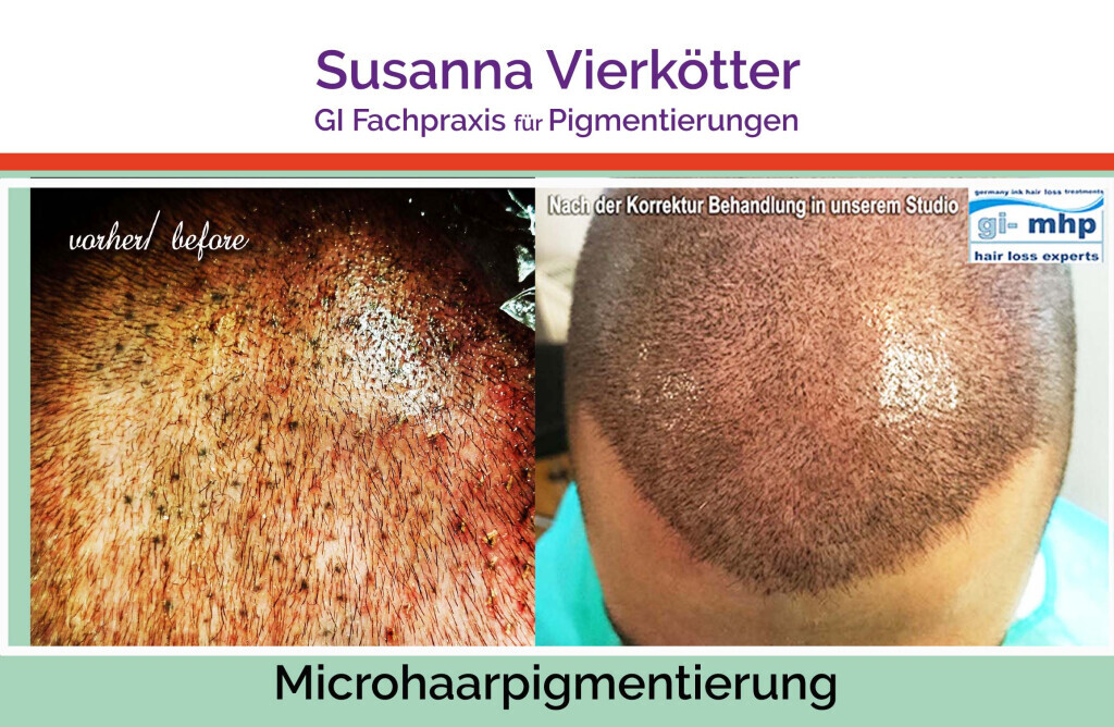Bilder GI-MHP Ultra Nano Haarpigmentierung