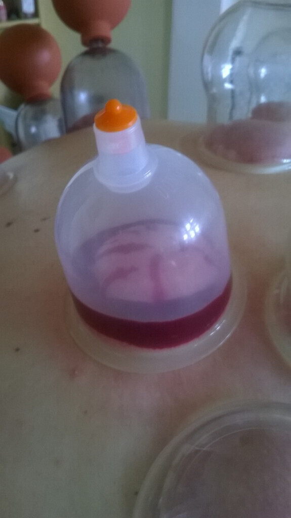 Bilder Hildegard von Bingen Berlin Daniela Dumann Heilpraktikerin