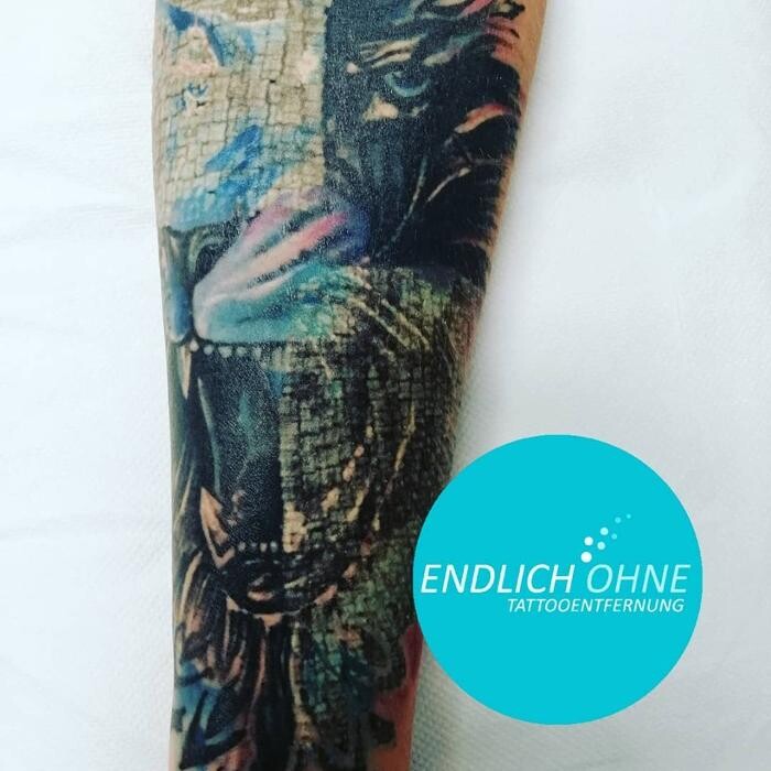 Bilder ENDLICH OHNE Tattooentfernung Filiale Bonn