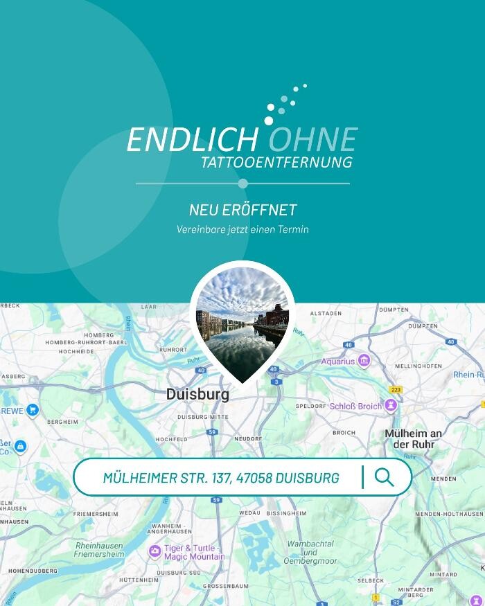 Bilder ENDLICH OHNE Tattooentfernung Filiale Bonn