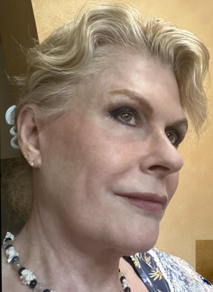 Bilder Kfz Sachverständiger Münstermann | Unfallgutachten | Schadengutachten| Autounfall