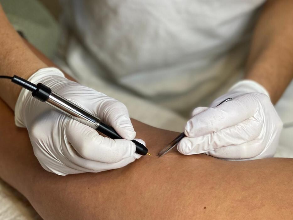 Bilder Katja Steinle - Less hair & care - dauerhafte Haarentfernung