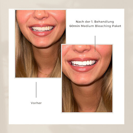 Bilder Natürlich Weiss by Asli