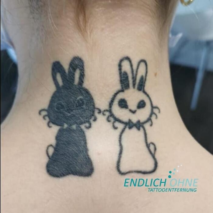 Bilder ENDLICH OHNE Tattooentfernung Filiale Hannover