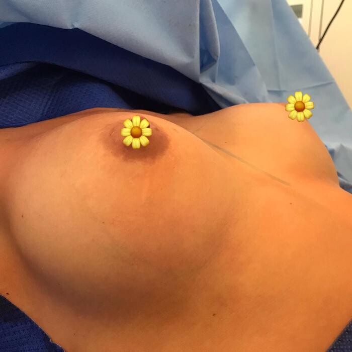 Bilder Plastische Chirurgie Dr. Solz