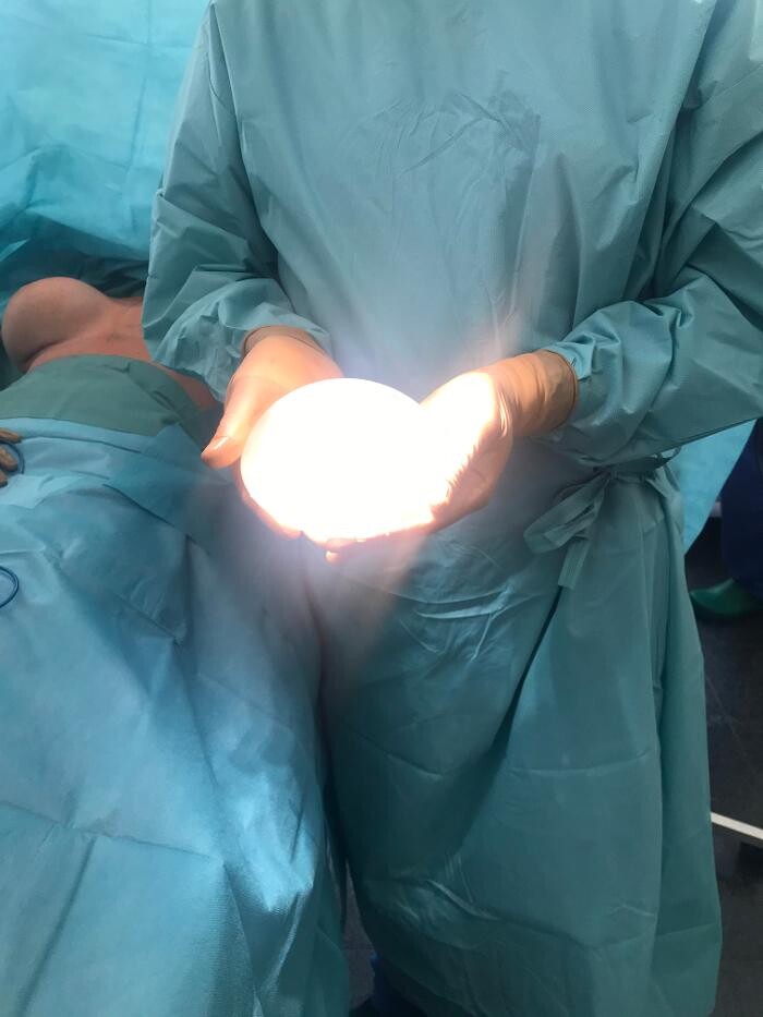 Bilder Plastische Chirurgie Dr. Solz