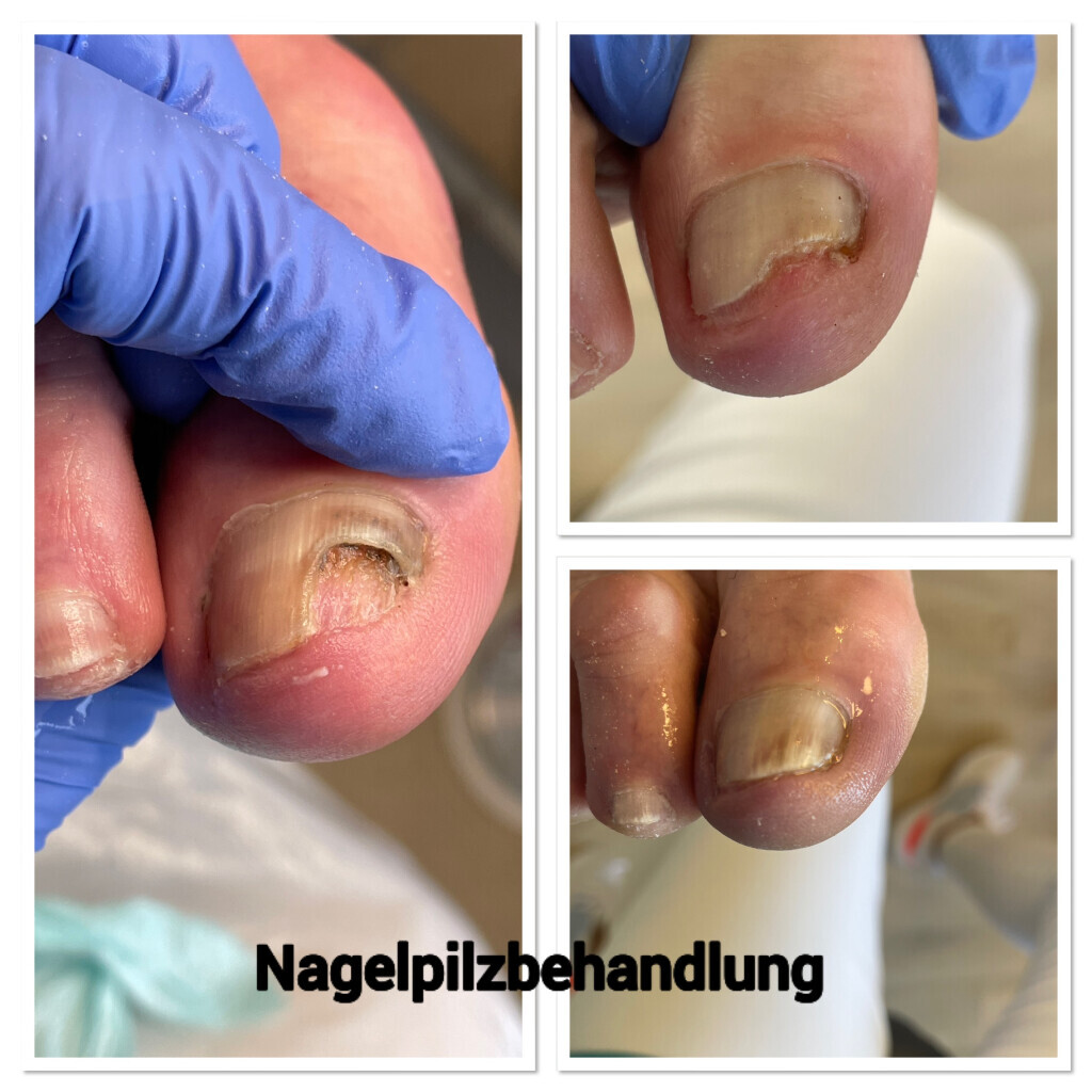 Bilder Podologische Praxis Brunsch