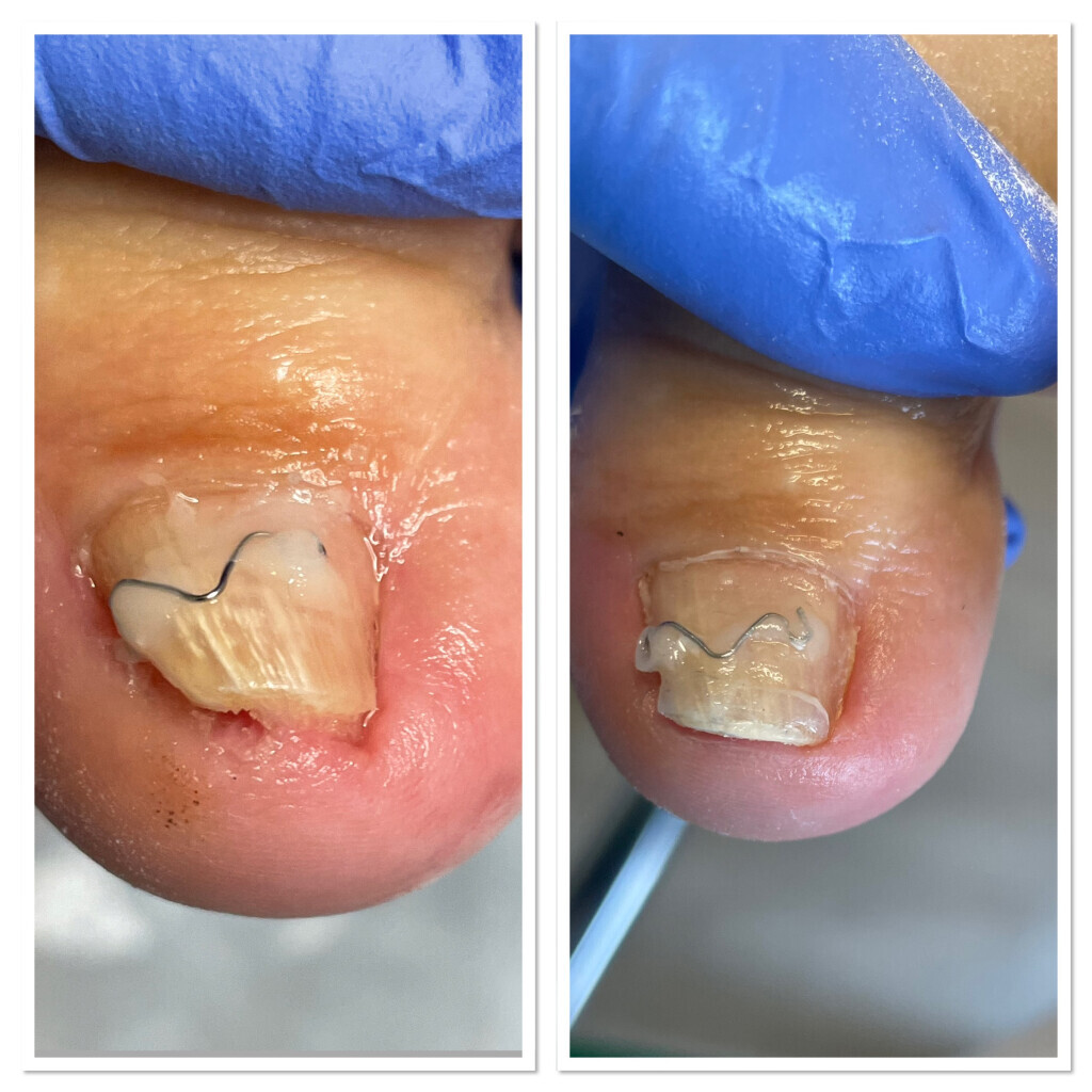 Bilder Podologische Praxis Brunsch