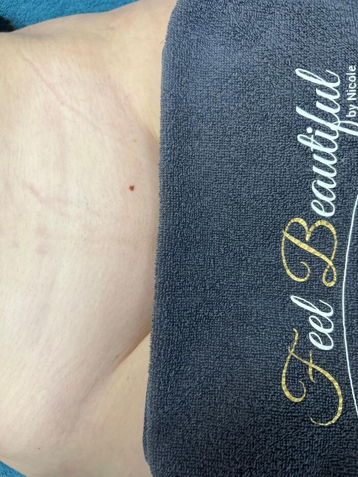 Bilder Feel Beautiful by Nicole - Dauerhafte Haarentfernung, Hautverjüngung und Beckenbodentraining