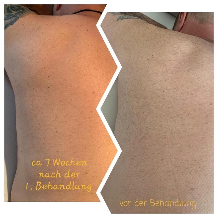Bilder Feel Beautiful by Nicole - Dauerhafte Haarentfernung, Hautverjüngung und Beckenbodentraining