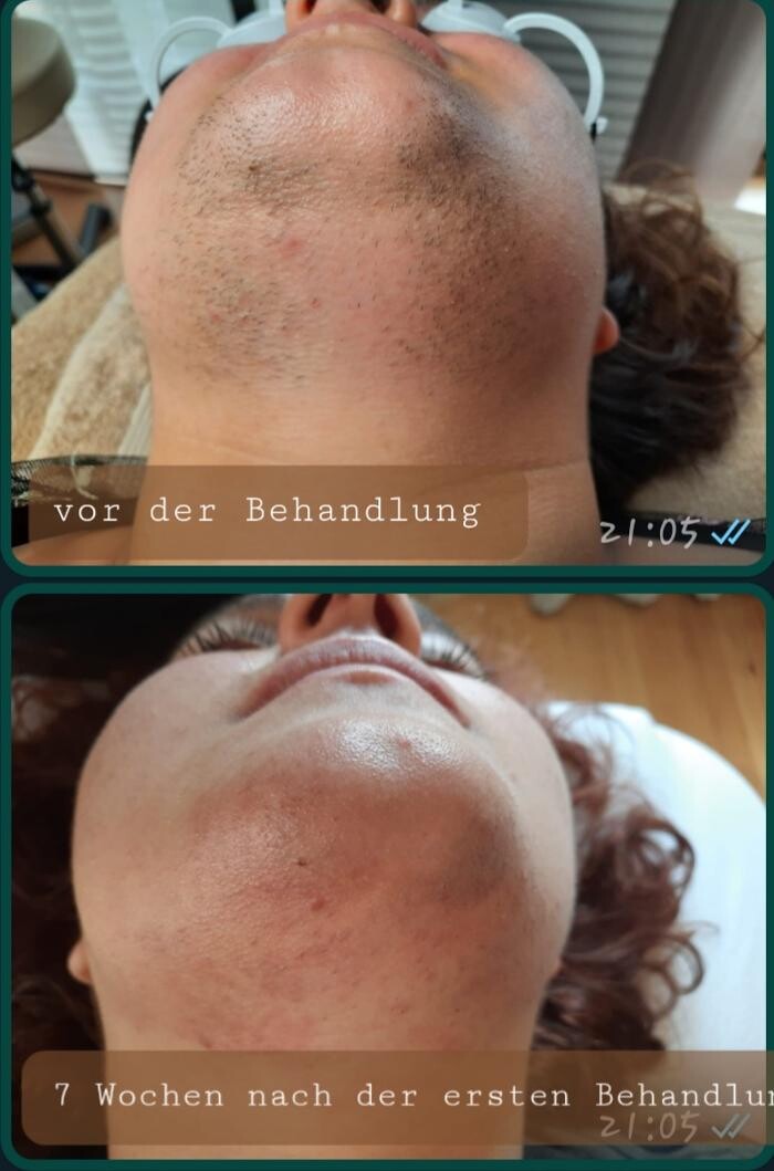 Bilder Feel Beautiful by Nicole - Dauerhafte Haarentfernung, Hautverjüngung und Beckenbodentraining