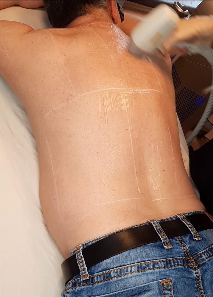 Bilder Feel Beautiful by Nicole - Dauerhafte Haarentfernung, Hautverjüngung und Beckenbodentraining