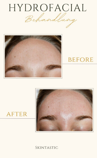 Bilder Skintastic Julia Riemer