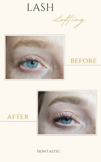 Bilder Skintastic Julia Riemer