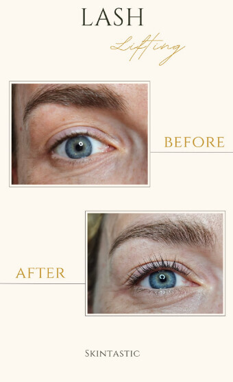 Bilder Skintastic Julia Riemer