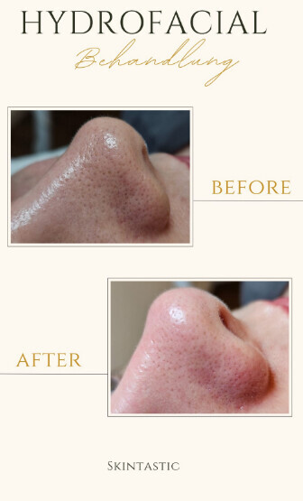 Bilder Skintastic Julia Riemer