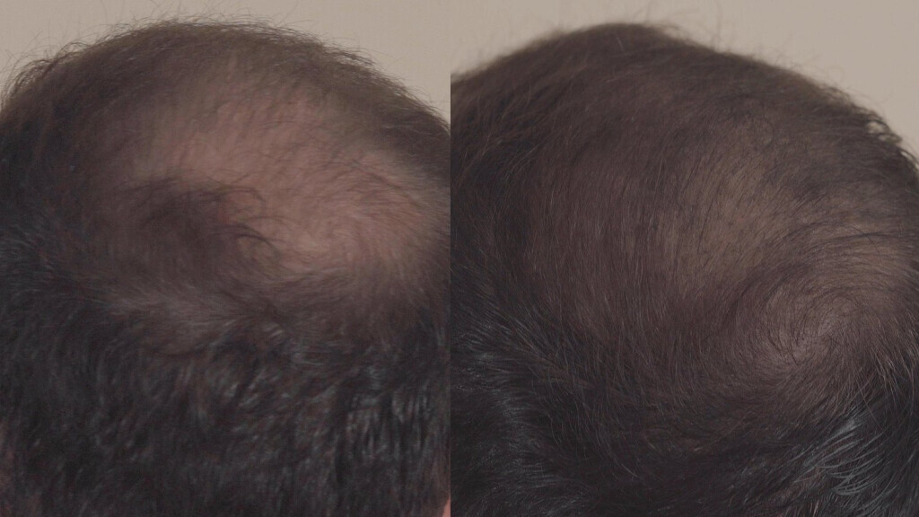 Bilder LEXUR GmbH - Manufaktur für Naturkosmetik