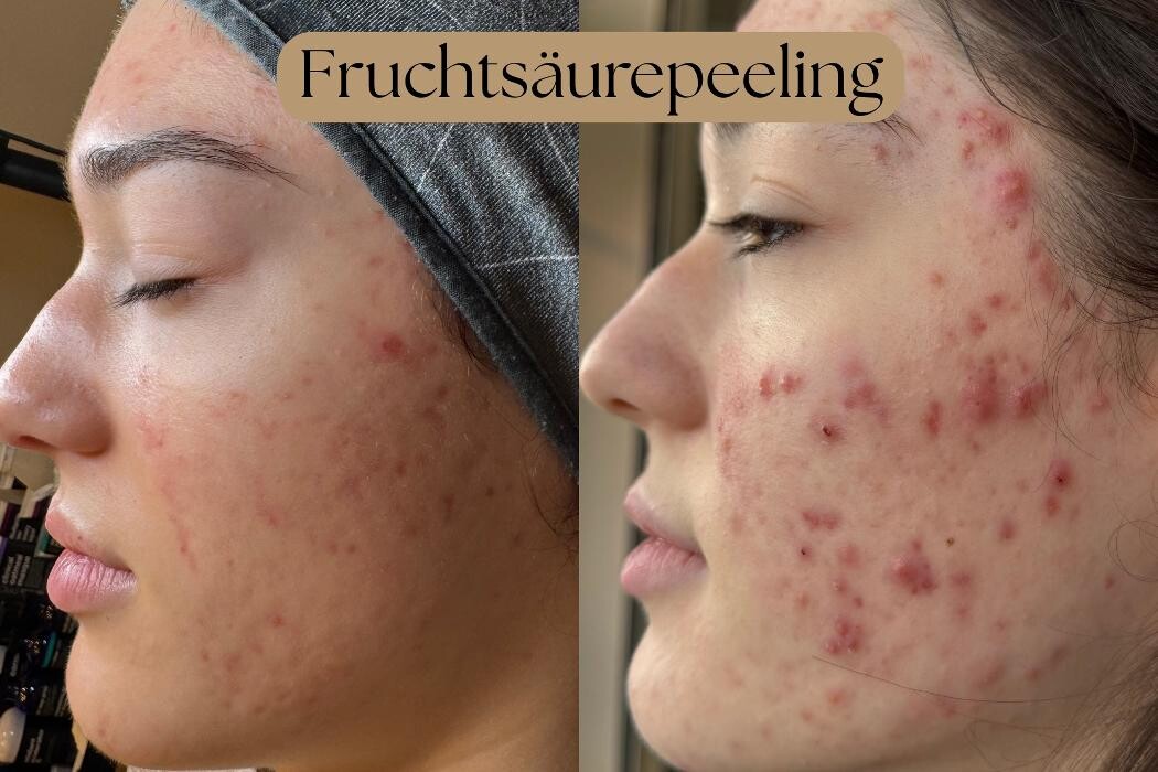Bilder NABEAU - Natural Aesthetic & Beauty | Hautverjüngung Berlin