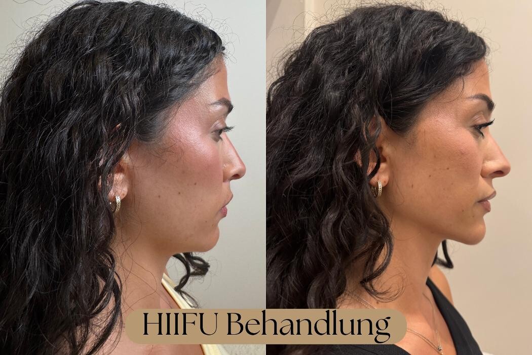 Bilder NABEAU - Natural Aesthetic & Beauty | Hautverjüngung Berlin