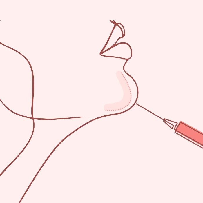 Bilder glow up clinic