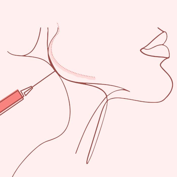 Bilder glow up clinic