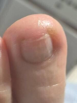 Bilder PodoAkitve Berlin