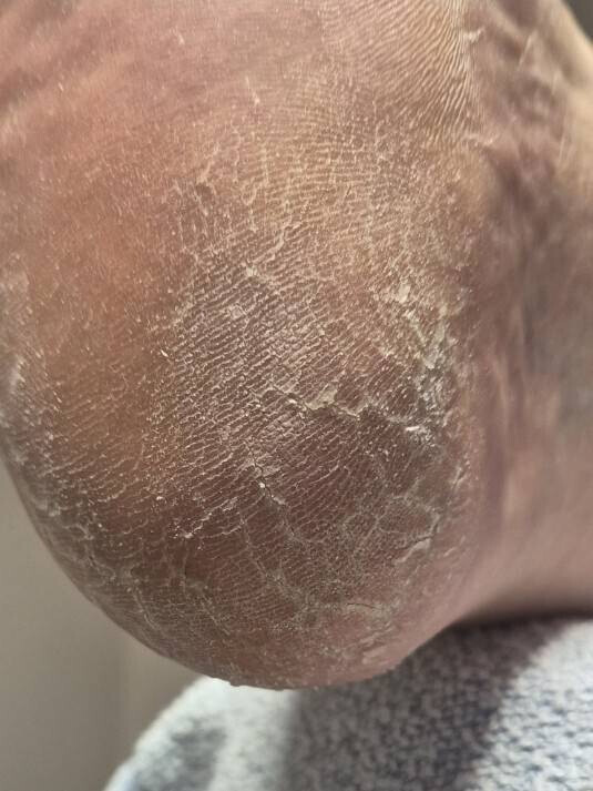 Bilder PodoAkitve Berlin