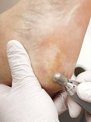 Bilder PodoAkitve Berlin