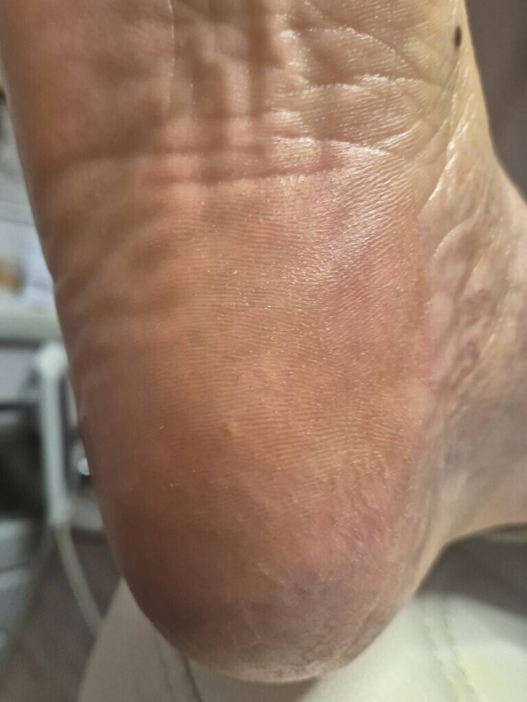 Bilder PodoAkitve Berlin