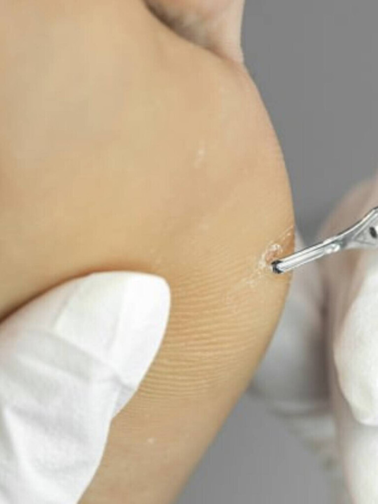 Bilder PodoAkitve Berlin