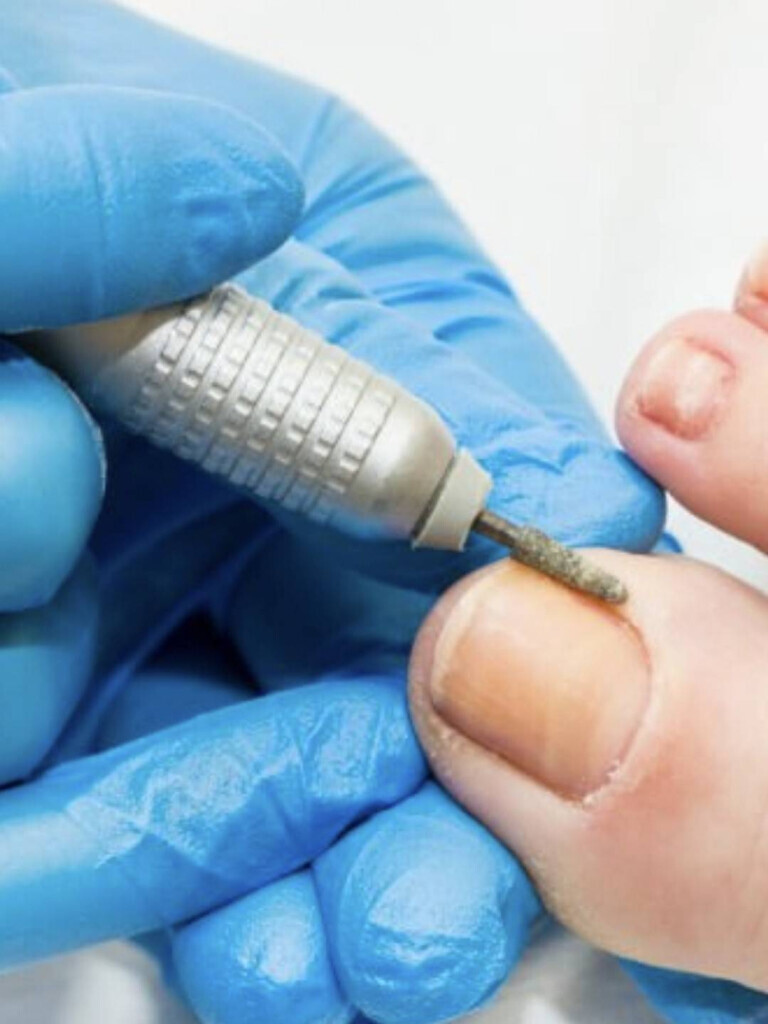 Bilder PodoAkitve Berlin