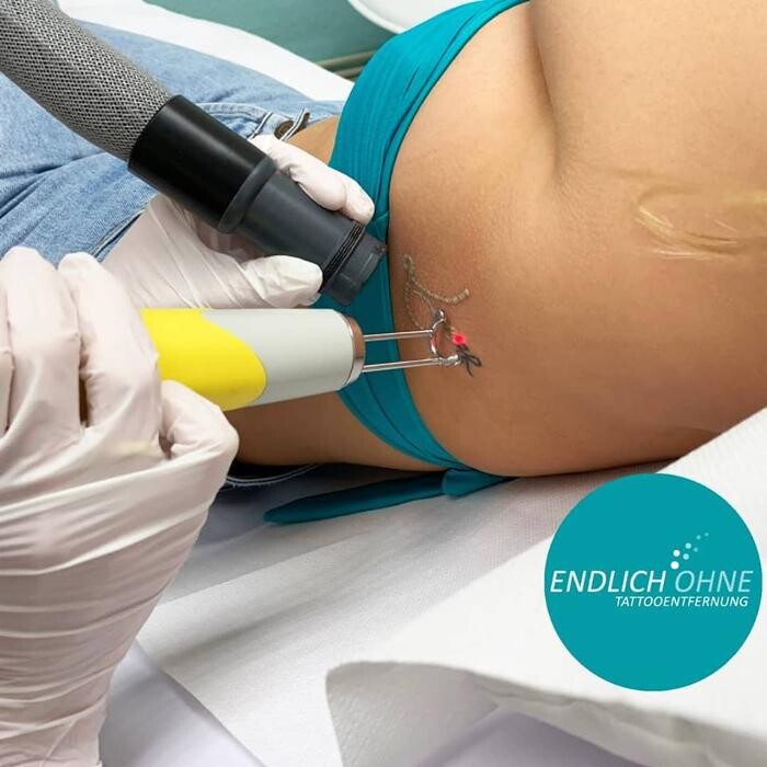 Bilder ENDLICH OHNE Tattooentfernung Filiale Berlin