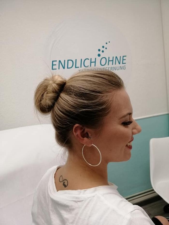 Bilder ENDLICH OHNE Tattooentfernung Filiale Berlin